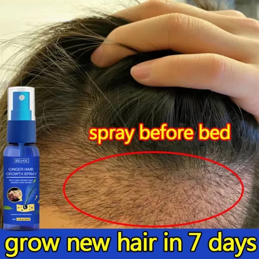 Hair Care Natural Products - Snelle gember haar groeispray, wortelversterkend, tegen