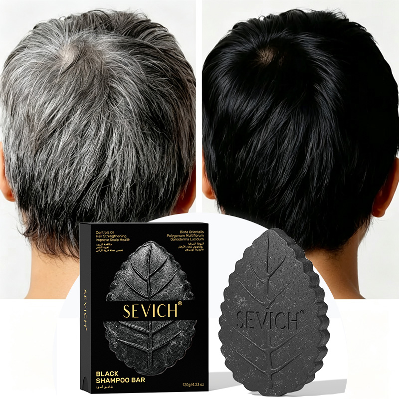 Sevich Zwarte Haarzeep Verduis - Hair Care Natural Products recensie en prijs